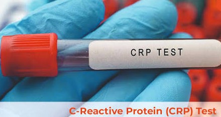 C-REACTIVEPROTEIN (CRP)